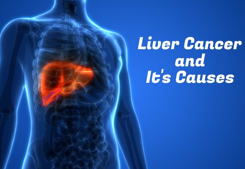 Everything to know about Liver cancer and its causes