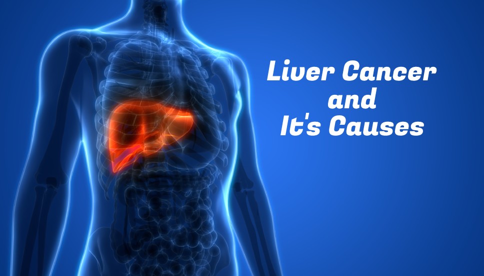 Everything to know about Liver cancer and its causes